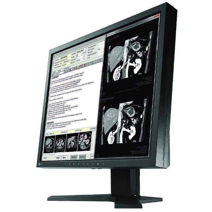 Медицински монитор EIZO RadiForce MX194 1MP Цветен-3
